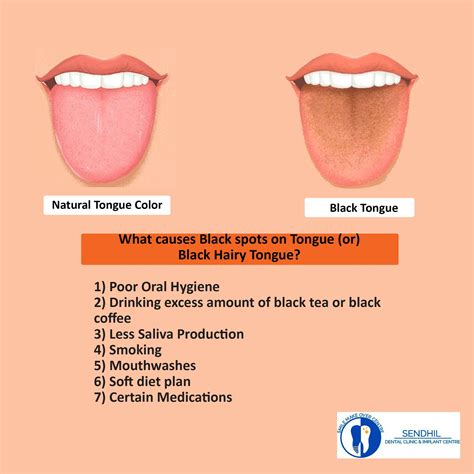 waking up with black tongue|black tongue on left side.